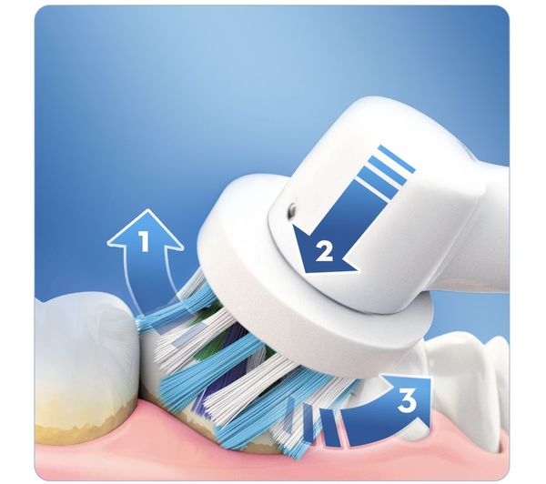 oral b 4000n review